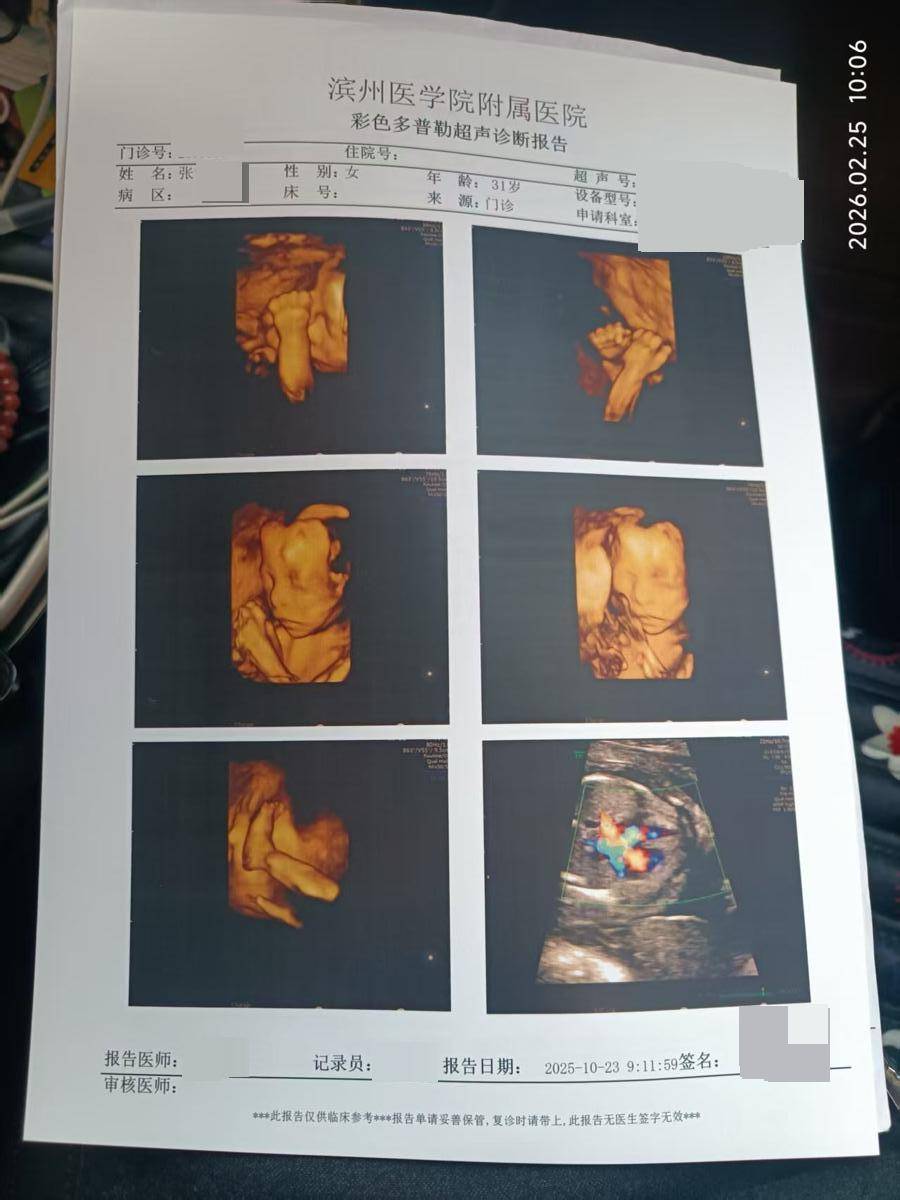 试管男婴出生右脚缺4根脚趾<strong></p>
<p>蒂森克科技</strong>，31岁产妇号啕大哭，家属称大排畸未拍到右脚照片，当地卫健委已介入调查:蒂森克科技